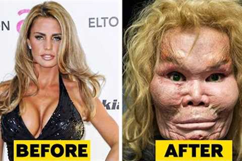 20 Celebrity Plastic Surgery Disasters